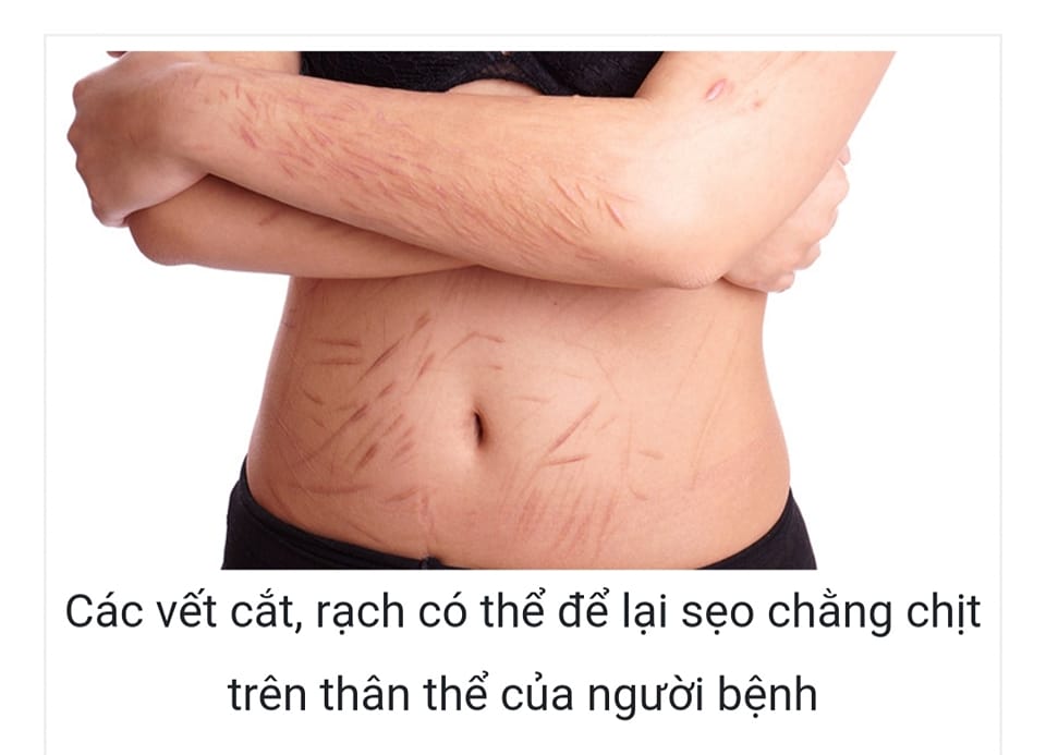 HỘI CHỨNG NGƯỢC ĐÃI BẢN THÂN