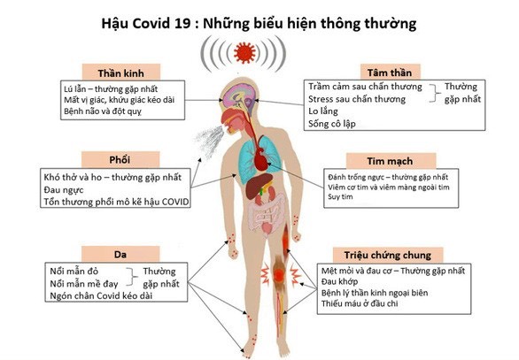 Một số tìm hiểu về Hội chứng hậu COVID-19.